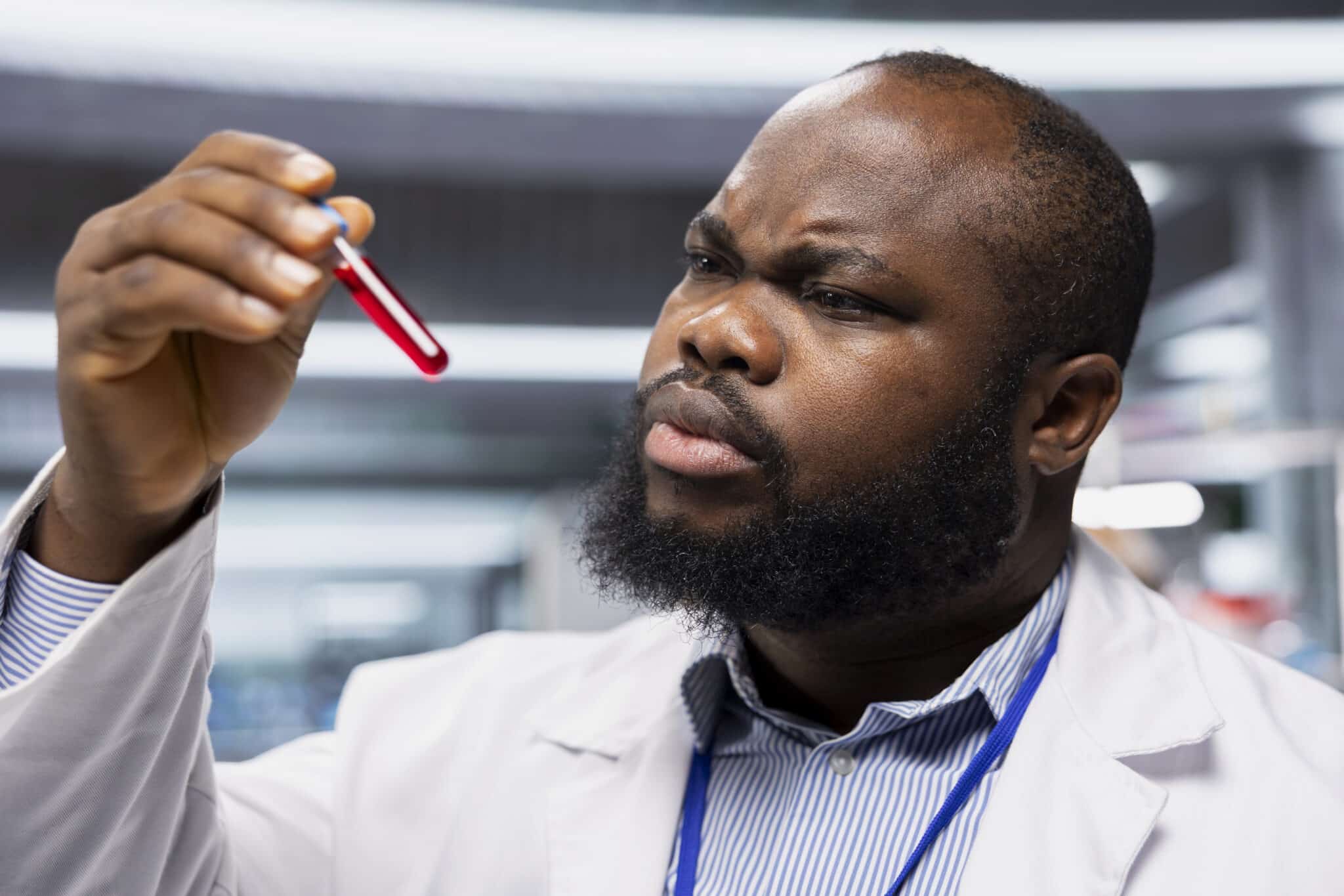 Drépanocytose : Comprendre, Agir et Sensibiliser face à cette maladie silencieuse