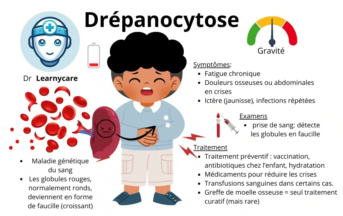 Les principaux symptômes de la drépanocytose